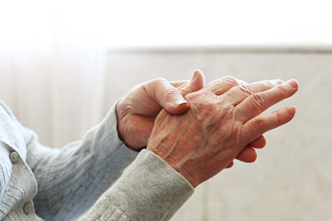 Rizartrosis: La artrosis de las manos